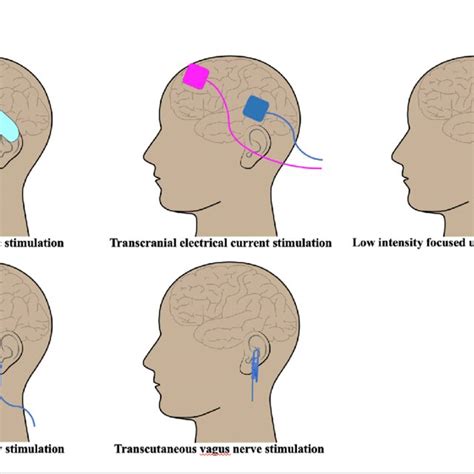 Contribution Of Noninvasive Brain Stimulation To Our Understanding Of Download Scientific