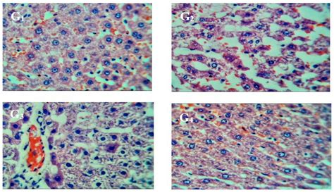 Liver Histopathology Of Rats Fed With Aloe Vera Juice At 100 X After