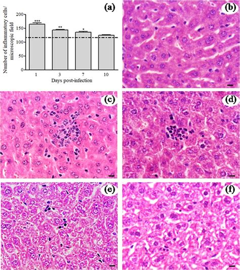 Histopathological Analysis Of Liver Tissues From Control And