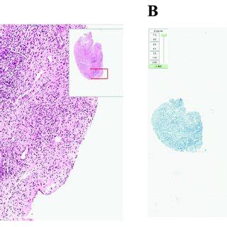 Histological And Immunohistochemical Analysis Of Frozen Thawed Ovarian