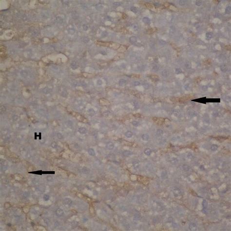 Photomicrograph Of A Section From The Liver Of Diazinon And Propolis