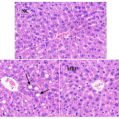 Representative Microphotographs Of Liver Tissue Sections Of C57BL 6J