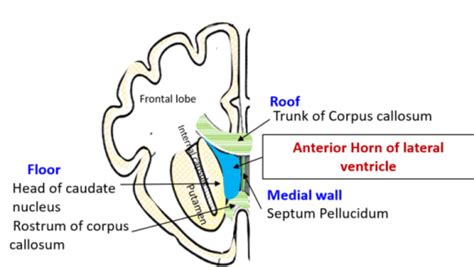 Lateral Ventricle , Parts, boundaries, tela choroidea, choroid plexus , Anatomy QA