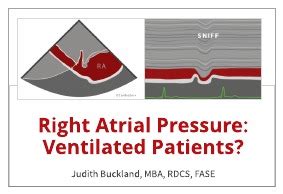 How to Estimate Right Atrial Pressure (RAP) Cardioserv