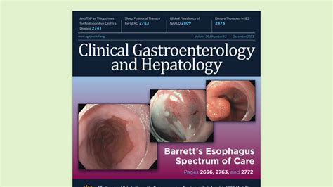 Adenoma and Sessile Serrated Lesion Detection Rates at Screening ...