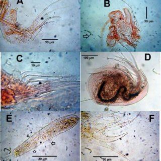 Cladocerans from a temporary pond, La Guajira. Moina micrura micrura ...