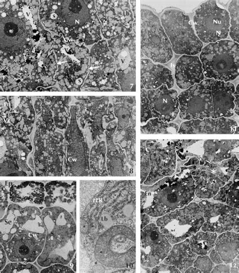 Figure From Ultrastructural Changes In Zygotic Embryos Of Gentiana