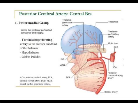 Posterior circulation stroke Syndromes