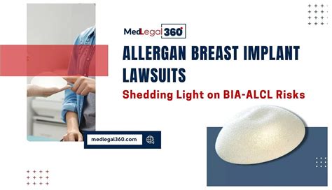 Allergan Breast Implant Lawsuits The Reality By Joebillyjoe Feb 2024 Medium