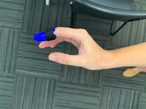 Therapy for Dislocated Finger: What's Involved? | Apricus Health