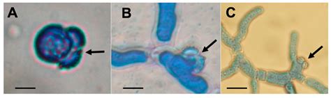 Jof Free Full Text Global Sexual Fertility In The Opportunistic Pathogen Aspergillus