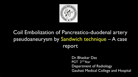 PDF Coil Embolization Of Pancreatico Duodenal Artery Pseudoaneurysm