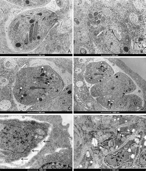 Transmission Electron Microscope Images After 48 H Of Toxoplasma Gondii