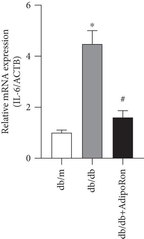 Effects Of AdipoRon On Inflammation Apoptosis And Fibrosis In The