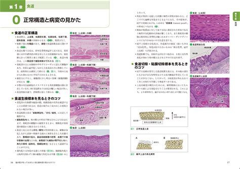 病理像内視鏡CTMRIで一目でわかる 臨床医が知っておきたい消化器病理の見かたのコツ 羊土社