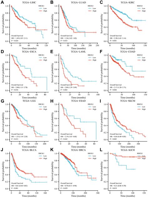 Rbck Overexpression Is Associated With Immune Cell Infiltration And