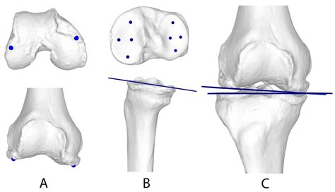 Jcm Free Full Text Validation Of A Three Dimensional Weight Bearing