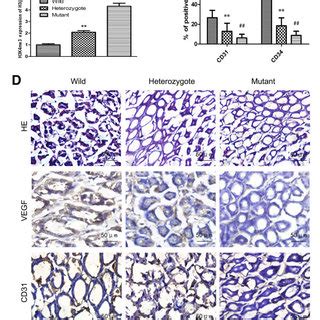 Promotion Of Tumorgenesis And Angiogenesis By RBP2 Induced VEGF