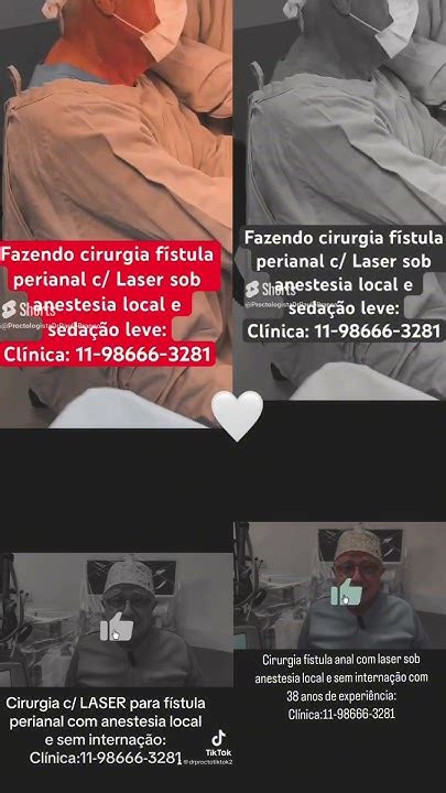 Assistam Cirurgias Laser Fissura Anal Fístula Pelinha Perianal C