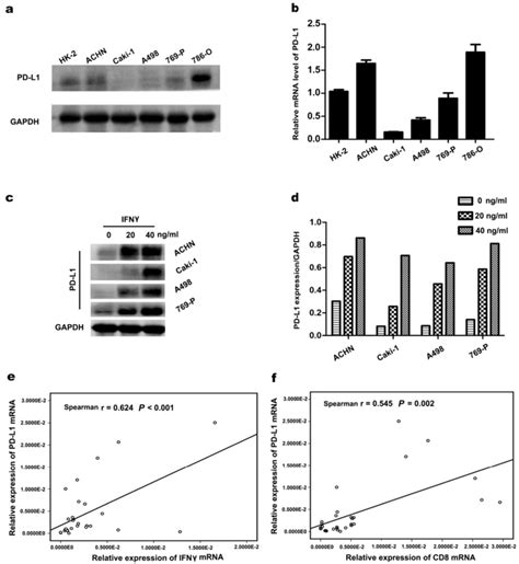 Correlation Between Pd L Expression And Ifn Or Cd In Ccrcc A