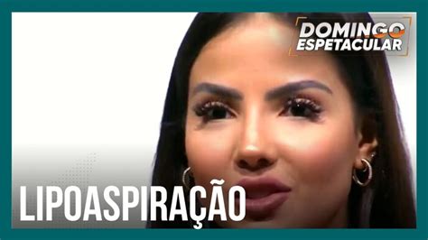 Domingo Espetacular explica como é feita a lipoaspiração que causou a