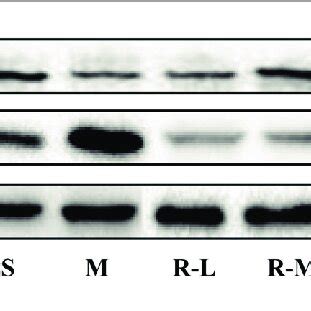 Effects Of Remifentanil On Protein Expression Levels Of IL 18 And