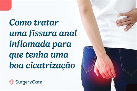 Como Tratar Uma Fissura Anal Para Que Tenha Uma Boa Cicatriza O