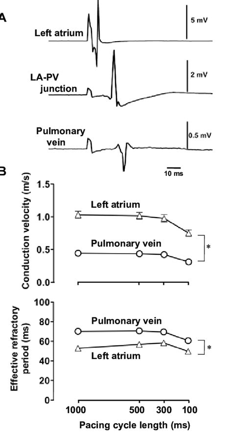 Electrophysiological Property Of Pulmonary Vein And Left Atrium A Download Scientific Diagram