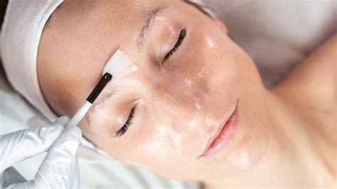 Chemical Peels Imaginesalonspaca