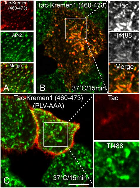 Delineation Of Endocytic Sorting Motif In Kremen Hela Cells