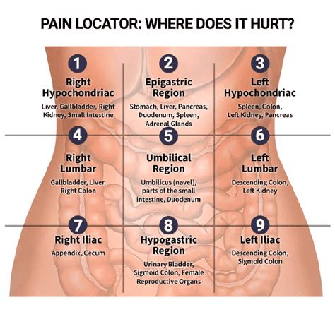 Abdominal Pain Chart Template Where Does It Hurt Download Printable