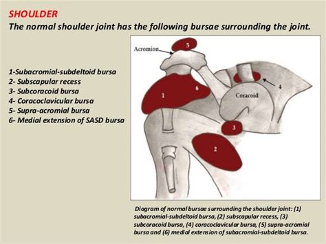 Presentation1 Pptx Radiological Imaging Of Bursae