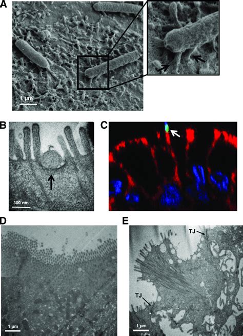 Enterohemorrhagic Escherichia Coli EHEC Forms Attaching And Effacing