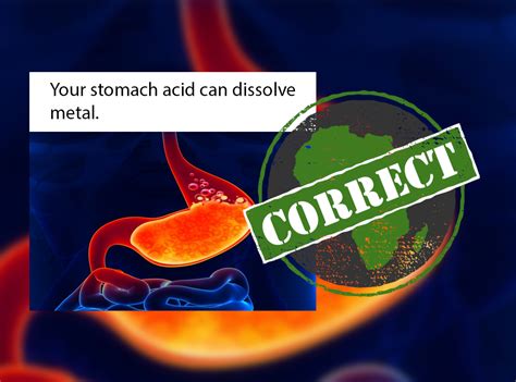 Yes Our Stomach Acid Can Theoretically Dissolve Some Metals But Don