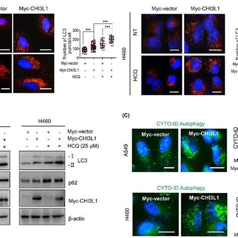 Chi L Enhances Formation Of Autophagosomes In Human Lung Cancer Cells