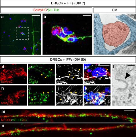 In Vitro Reconstitution Of The Muscle Spindles A Co Cultures Of Drgos