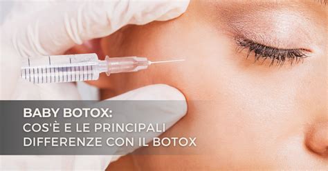 Baby botox cos è e le principali differenze dal botox originario