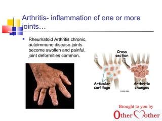 Disorder Of The Bones And Joints PPT