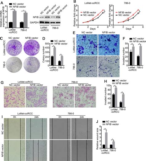 The High Expression Of Nfib Promotes The Proliferation And Migration Of