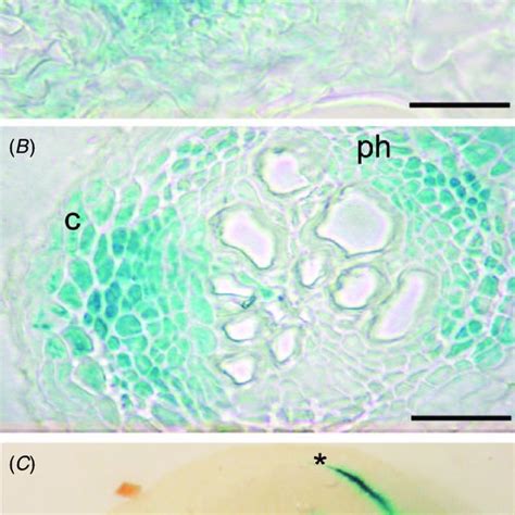 Transverse Sections Of Rosette Leaf A And Mature Root B Of