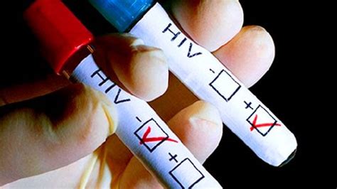 Gratuito Teste De Hiv Importante Para Diagn Stico Precoce Gappa