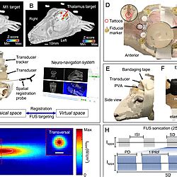 Schematics Of The Experimental Settings With Neuro Navigation