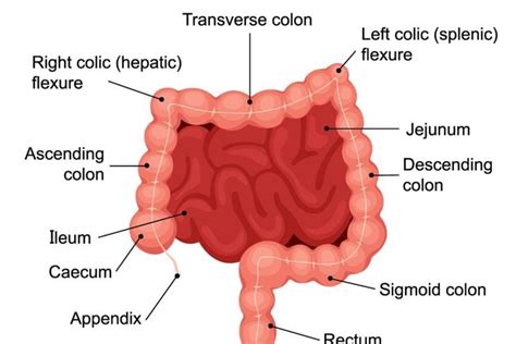 Types Of Ileostomy Procedures And Possible Risks Facty Health