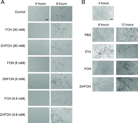 C Albicans Evs Foh And Dhfoh Reversed The Yeast To Hypha Download Scientific Diagram