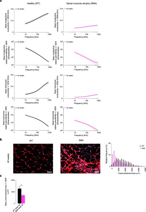 Permittivity Of Ex Vivo Healthy And Diseased Murine Skeletal Muscle