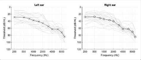 Mean Air Conduction Pure Tone Thresholds For Listeners Left Ears Left Download Scientific