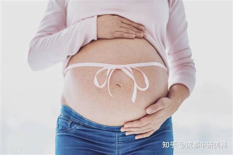 孕期如有以下4个特征，妊娠纹会离你远远的 知乎