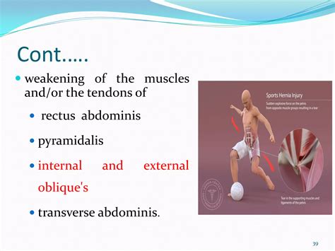 Groin Injuries Pdf