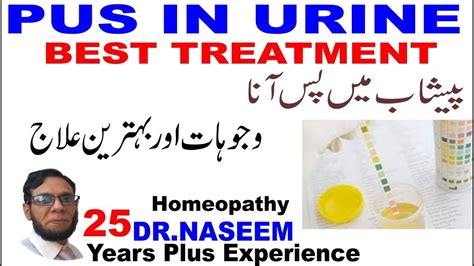 Pus Cells In Urine Treatment Causes Homeopathic Urine Mein Pus Cells