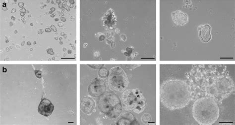 3d Organization Of Mammary Epithelial Cells Primary Mammospheres After